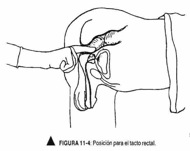 exgenitales03